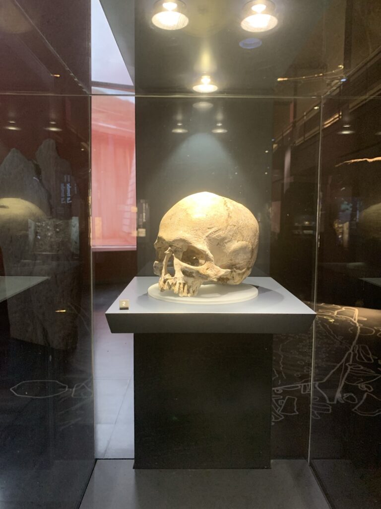 The remains of a human skull.